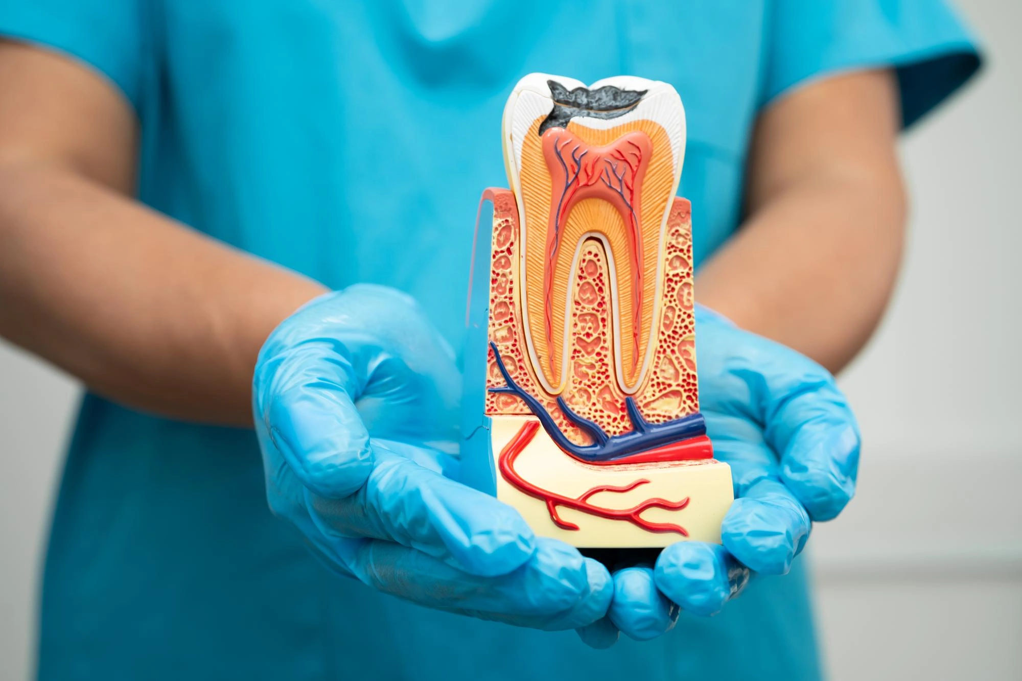 Can Root Canal Save a Severely Damaged Tooth?