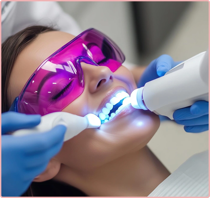 teeth whitening in chennai