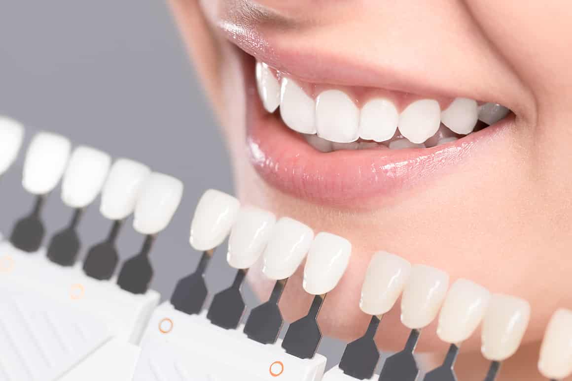 aesthetic dentistry in chennai