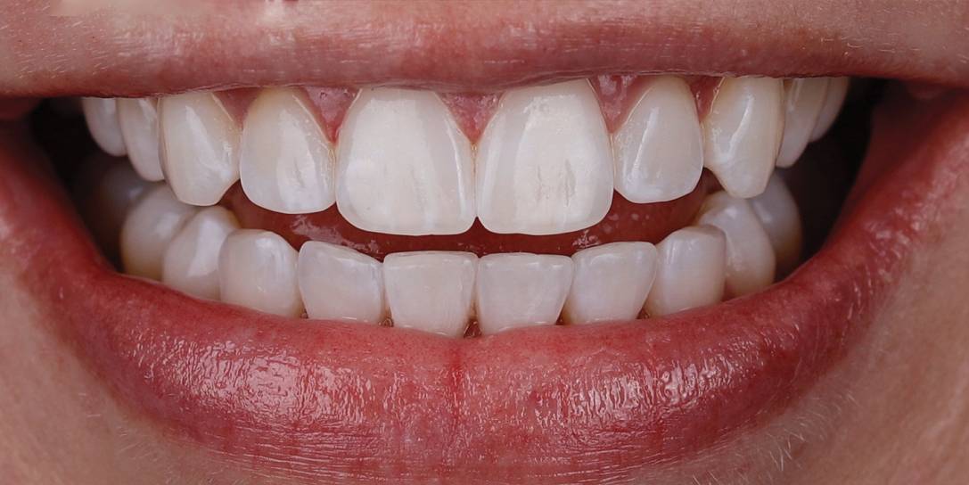 best orthodontics treatment in chennai